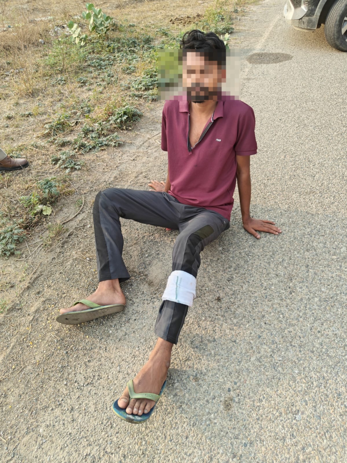 घायल बदमाश घायल बदमाश