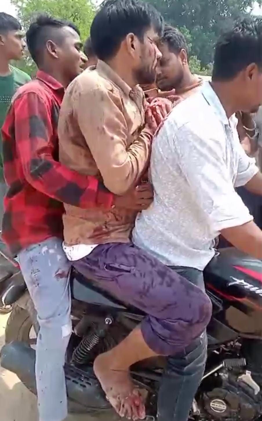 तेंदुआ के हमले में घायल युवक