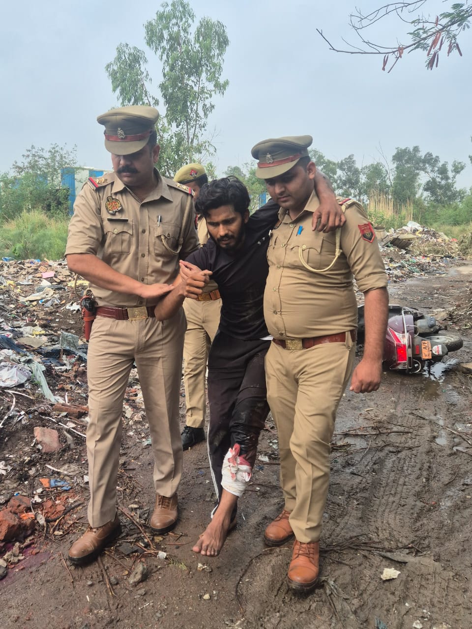 घायल बदमाश घायल बदमाश