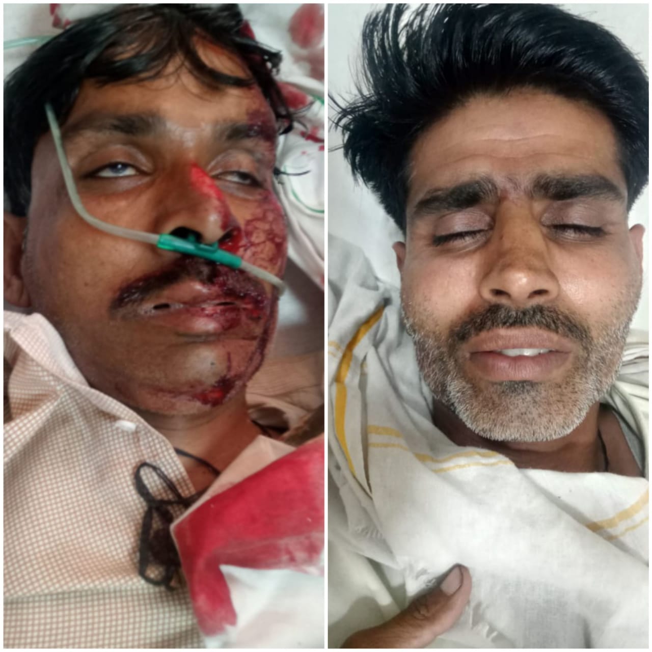 दो युवक घायल, हालत गंभीर दो युवक घायल, हालत गंभीर