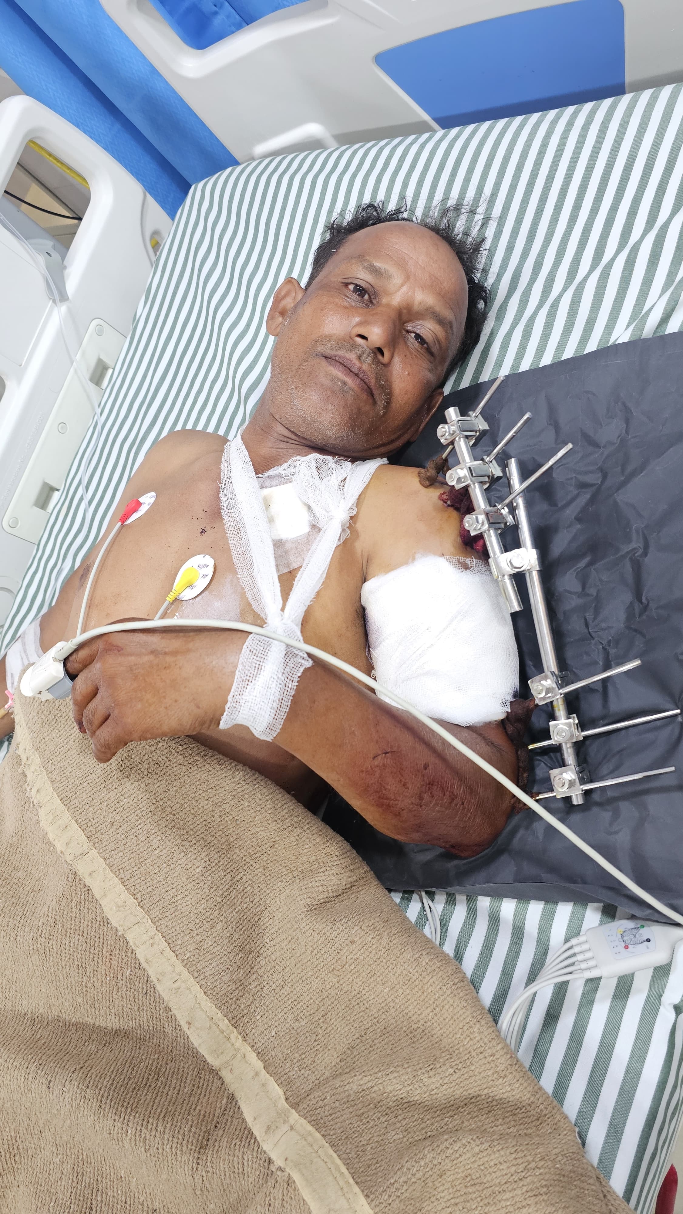मकान पर घुसे चोर ने पीछा करने पर व्यक्ति पर की फायरिंग, कंधे पर लगी गोली मकान पर घुसे चोर ने पीछा करने पर व्यक्ति पर की फायरिंग, कंधे पर लगी गोली