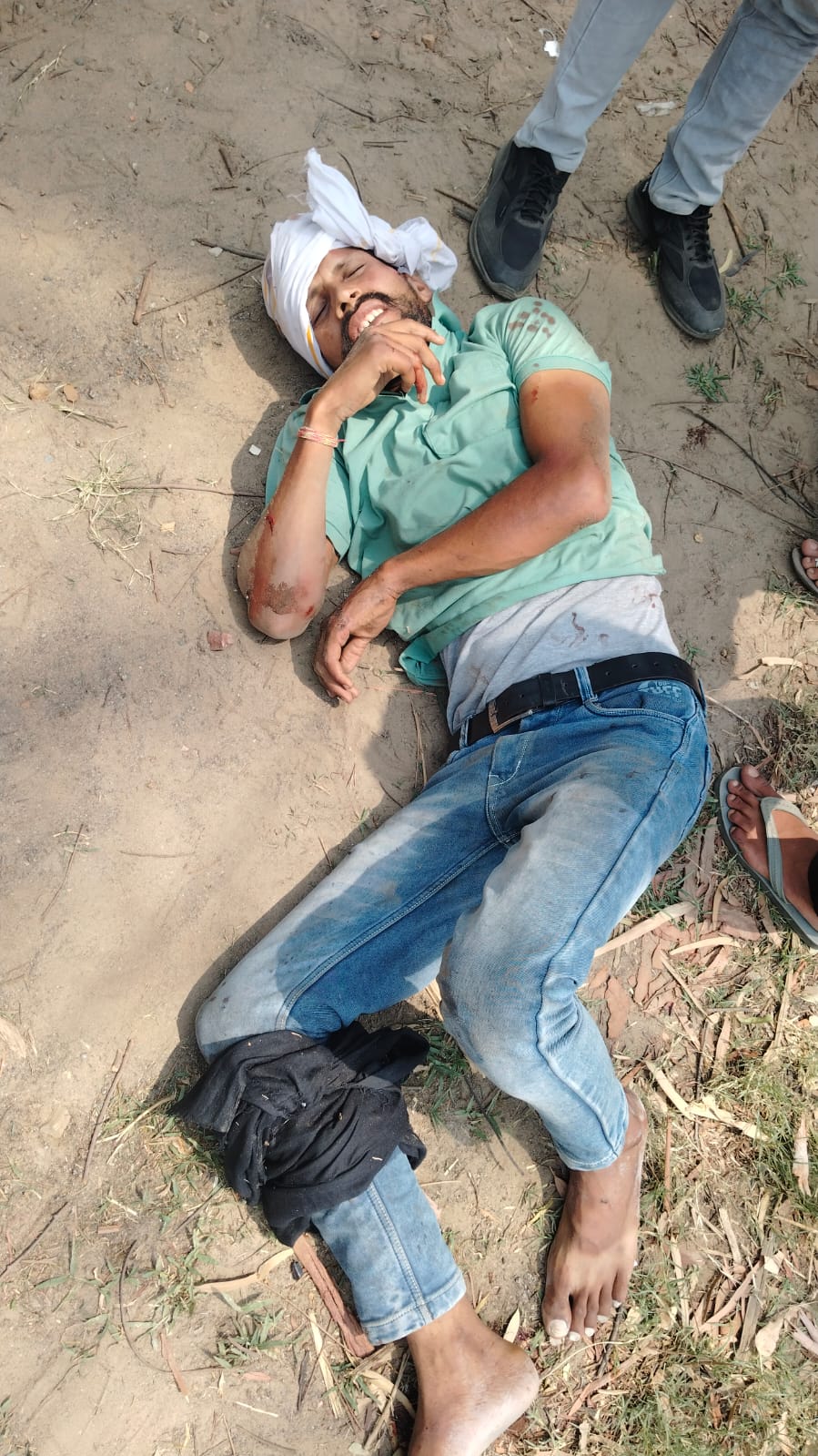 दुर्घटना के बाद सड़क किनारे घायल अवस्था में पड़े युवक दुर्घटना के बाद सड़क किनारे घायल अवस्था में पड़े युवक