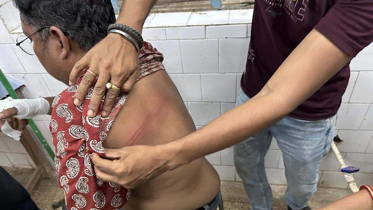 खातरा बाजार में मंत्री के पति पर हमला खातरा बाजार में मंत्री के पति पर हमला