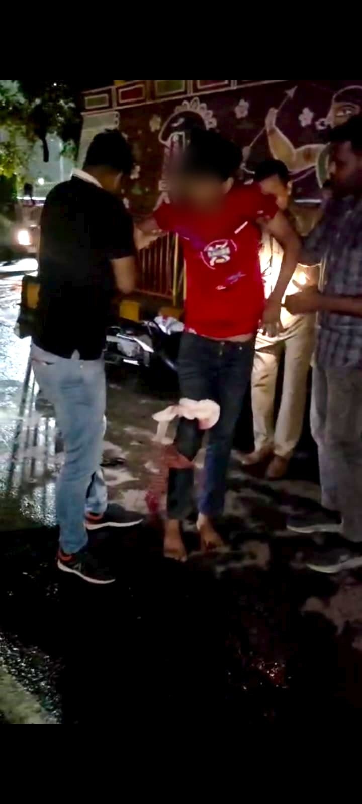 मुठभेड़ में घायल हुए बदमाश की फोटो मुठभेड़ में घायल हुए बदमाश की फोटो