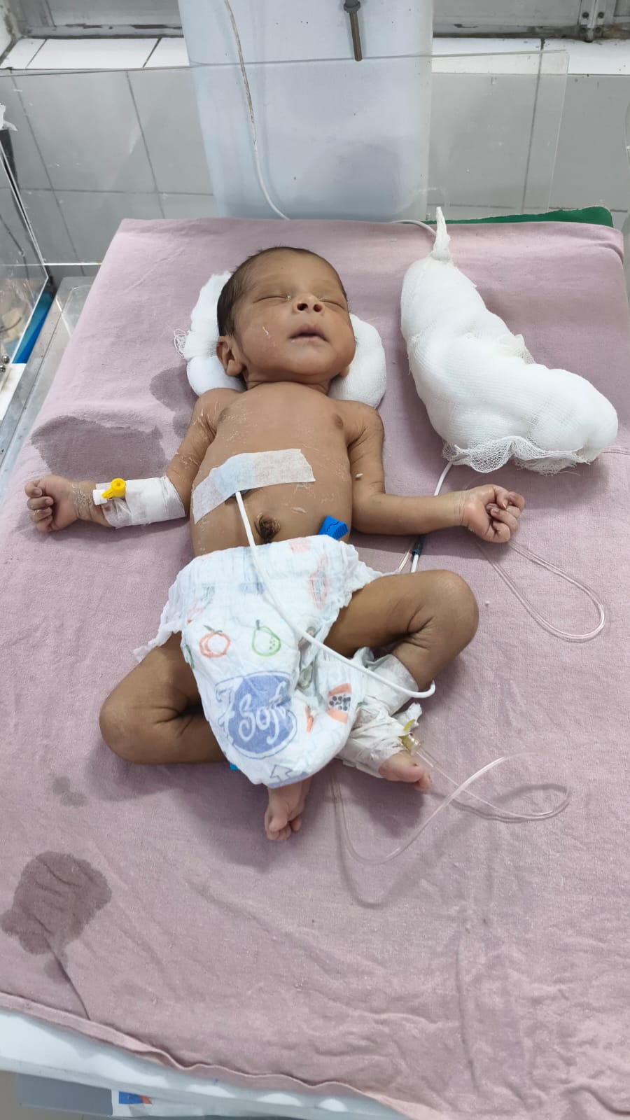 छह दिन पूर्व चंडीगढ़ समर स्पेशल ट्रेन में बैग में बंद मिला जिला अस्पताल में भर्ती नवजात शिशु। छह दिन पूर्व चंडीगढ़ समर स्पेशल ट्रेन में बैग में बंद मिला जिला अस्पताल में भर्ती नवजात शिशु।