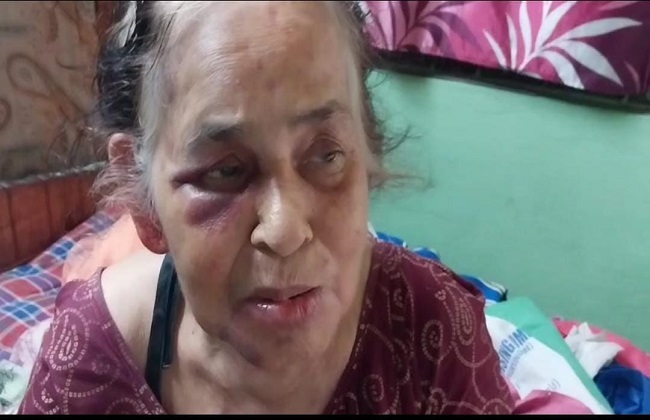 पीड़ित वृद्ध महिला पीड़ित वृद्ध महिला
