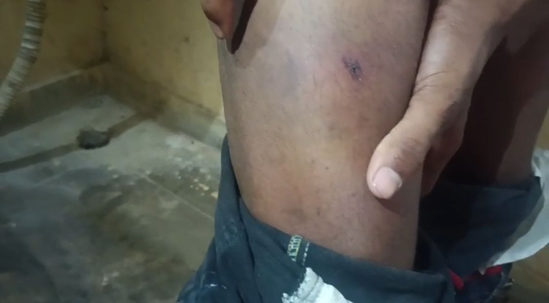 चोट के निशान 1 चोट के निशान 1