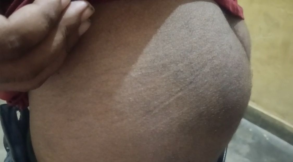 चोट के निशान 2 चोट के निशान 2