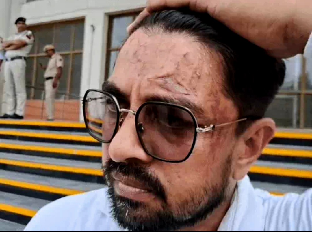 नरेंद्र ने आरोप लगाया कि पुलिसकर्मियों ने उसके सिर पर खूब चोट मारी है। नरेंद्र ने आरोप लगाया कि पुलिसकर्मियों ने उसके सिर पर खूब चोट मारी है।