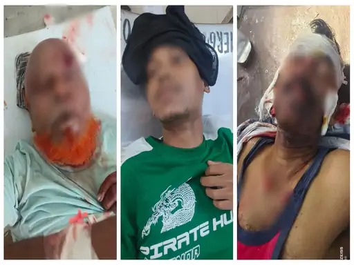 नशे में कार सवार युवक ने 5 लोगों को रौंद दिया, इनमें 3 की मौत, वहीं 3 गंभीर घायल नशे में कार सवार युवक ने 5 लोगों को रौंद दिया, इनमें 3 की मौत, वहीं 3 गंभीर घायल