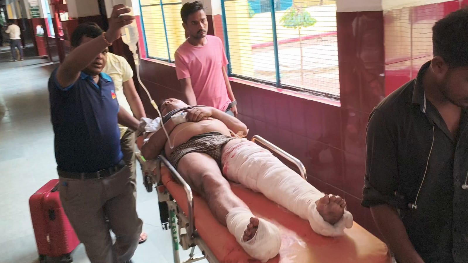 ट्रेन में पैर फिसलने से गंभीर रूप से घायल हुआ युवा मुकेश वर्मा जिला अस्पताल में उपचार के लिए जाते हुए। ट्रेन में पैर फिसलने से गंभीर रूप से घायल हुआ युवा मुकेश वर्मा जिला अस्पताल में उपचार के लिए जाते हुए।