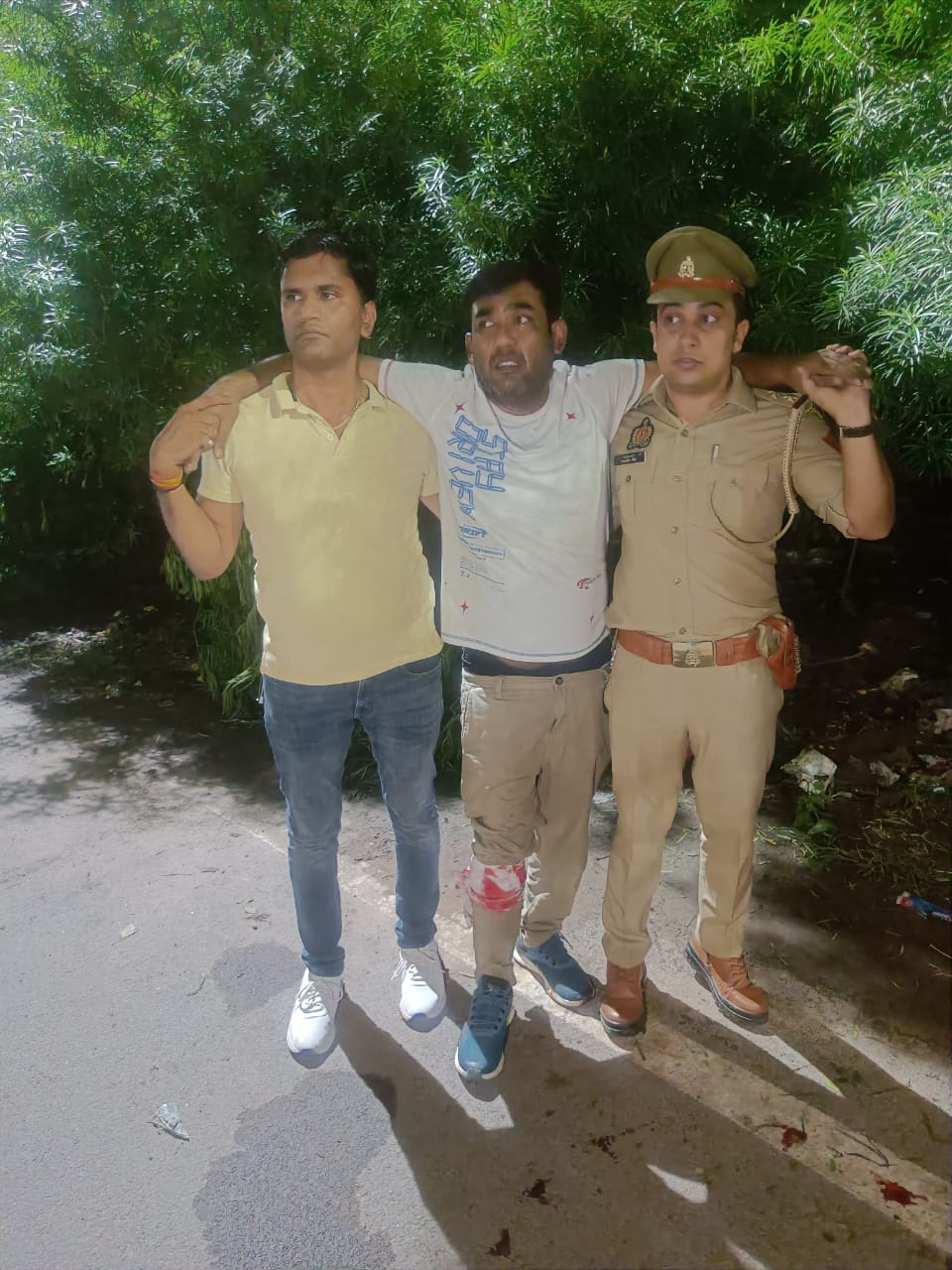 घायल बदमाश घायल बदमाश