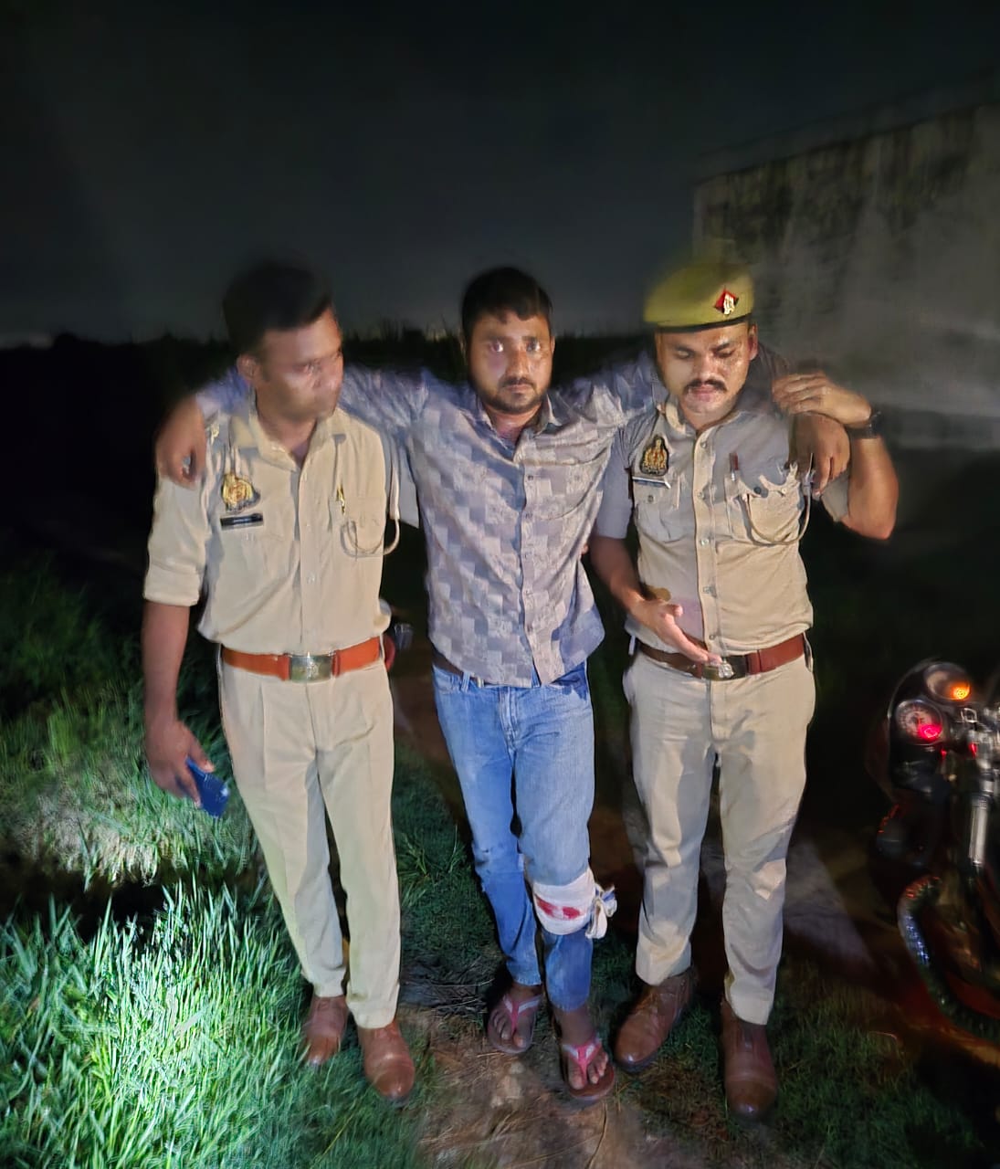 घायल बदमाश