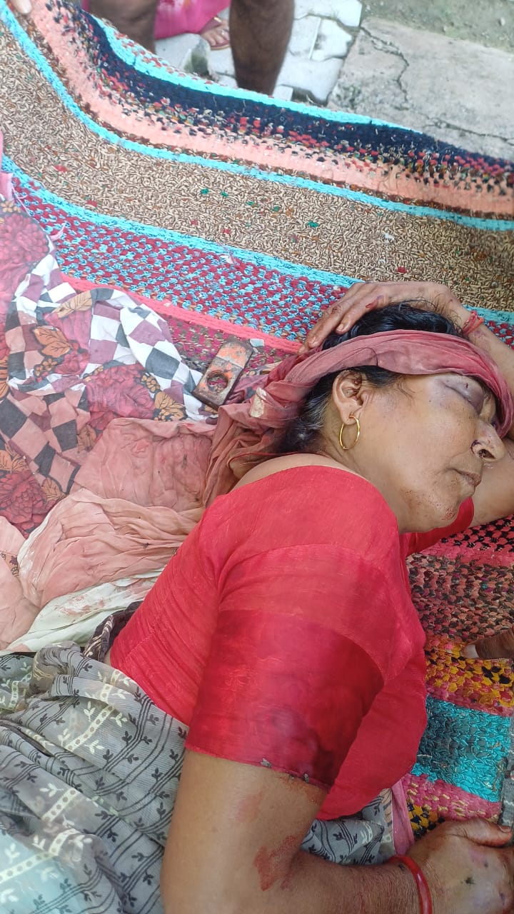 घायल महिला घायल महिला
