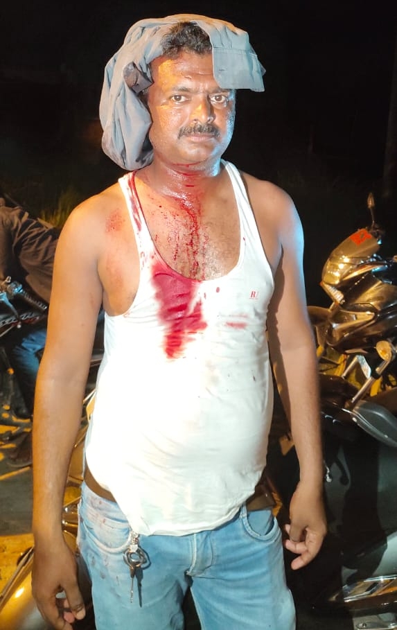गंभीर रूप घायल एफएसो इरफान