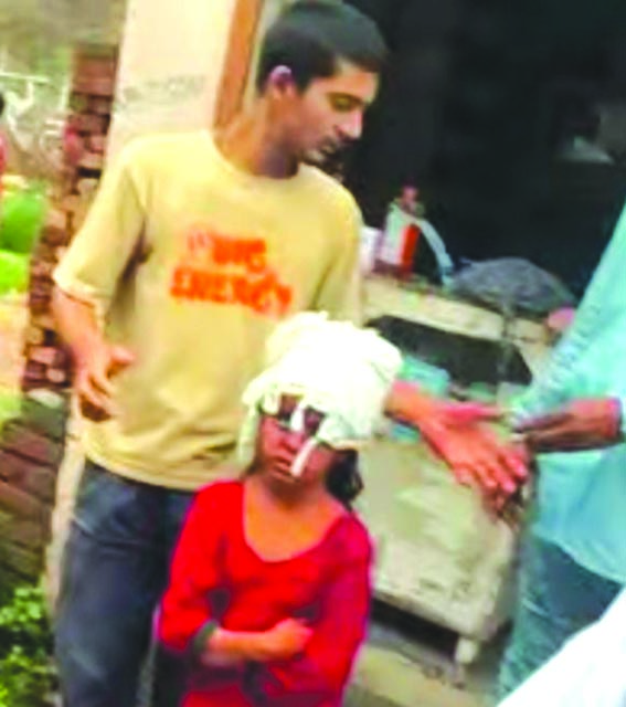 घायल बच्ची