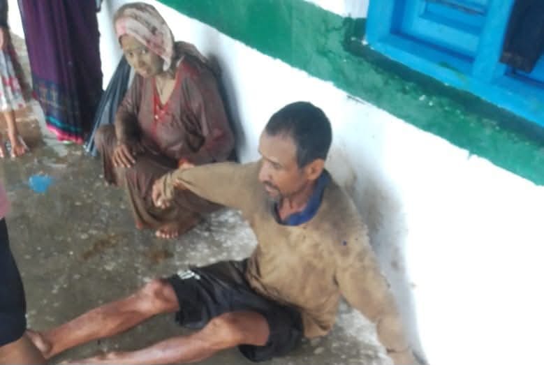 पौड़ी के बांकुड़ा गांव में मलवे से सुरक्षित निकाले नेपाली मजदूर