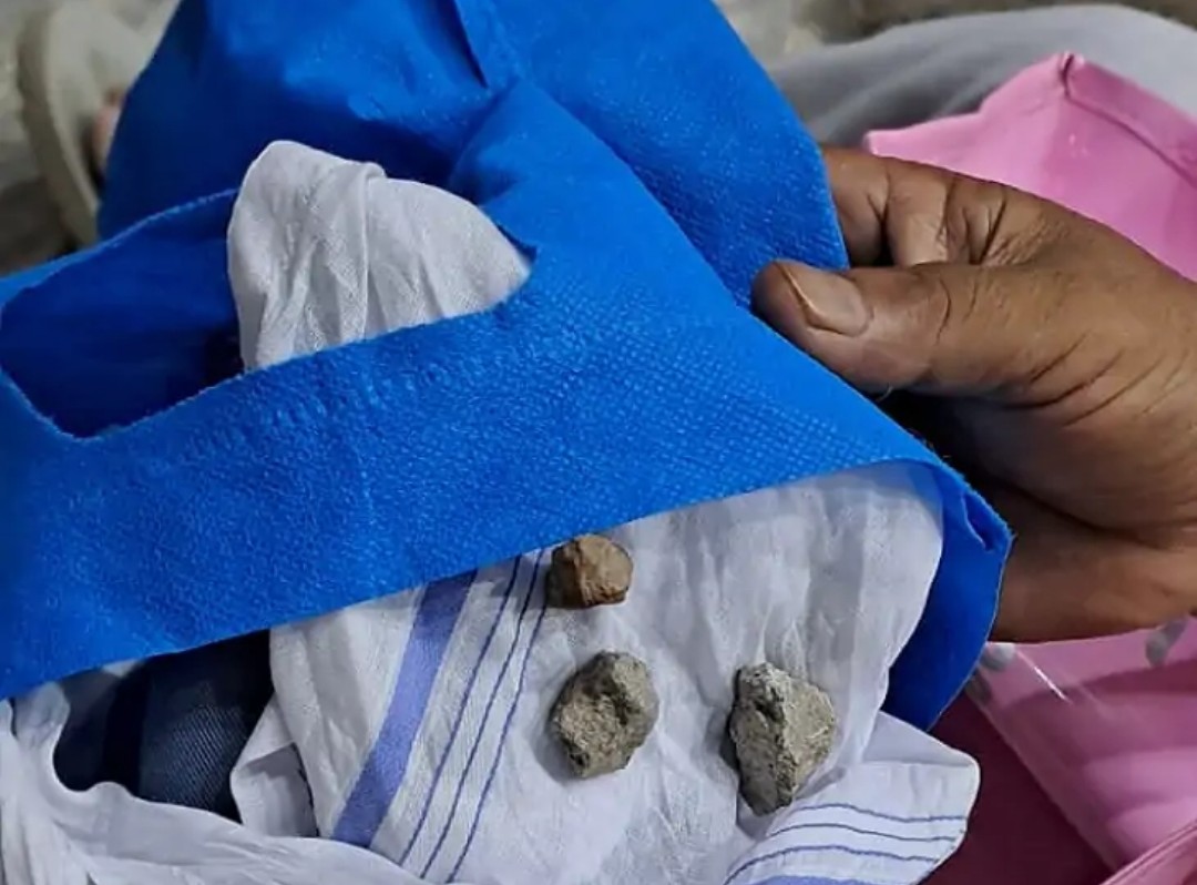 आरोपियों ने महिला को बदले में रुमाल में बंधे पत्थर थमाए और फरार हो गए। आरोपियों ने महिला को बदले में रुमाल में बंधे पत्थर थमाए और फरार हो गए।