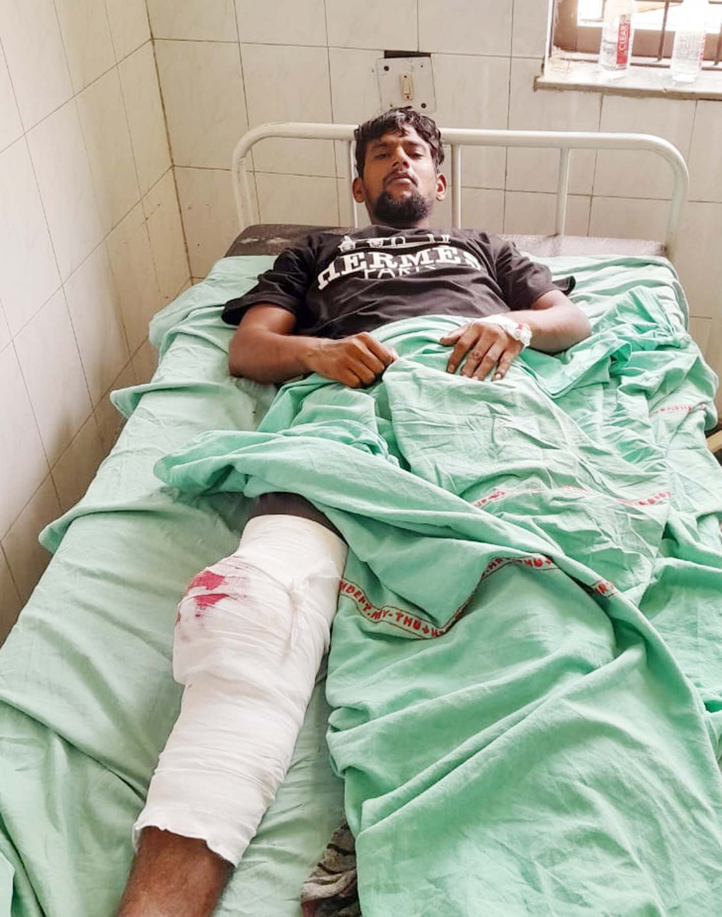 गुरुग्राम के अस्पताल में उपचाराधीन पुलिस मुठभेड़ में घायल हुआ बदमाश रमनदीप उर्फ पेट्रोल।