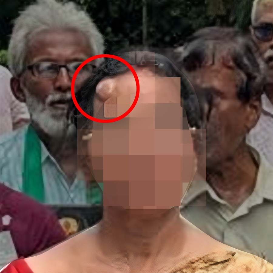 पीड़िता की घायल मां