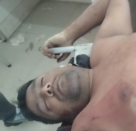 घायल मोहम्मद अंसार की फोटो घायल मोहम्मद अंसार की फोटो
