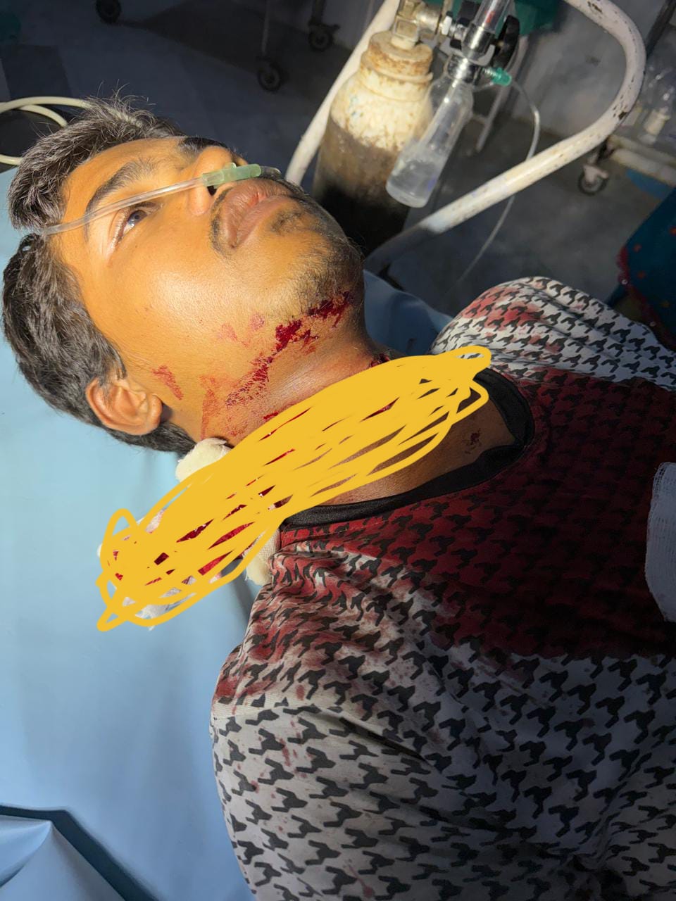 रतलाम : चाइना डोर के शिकार 18 वर्षीय युवक की जान बचाई