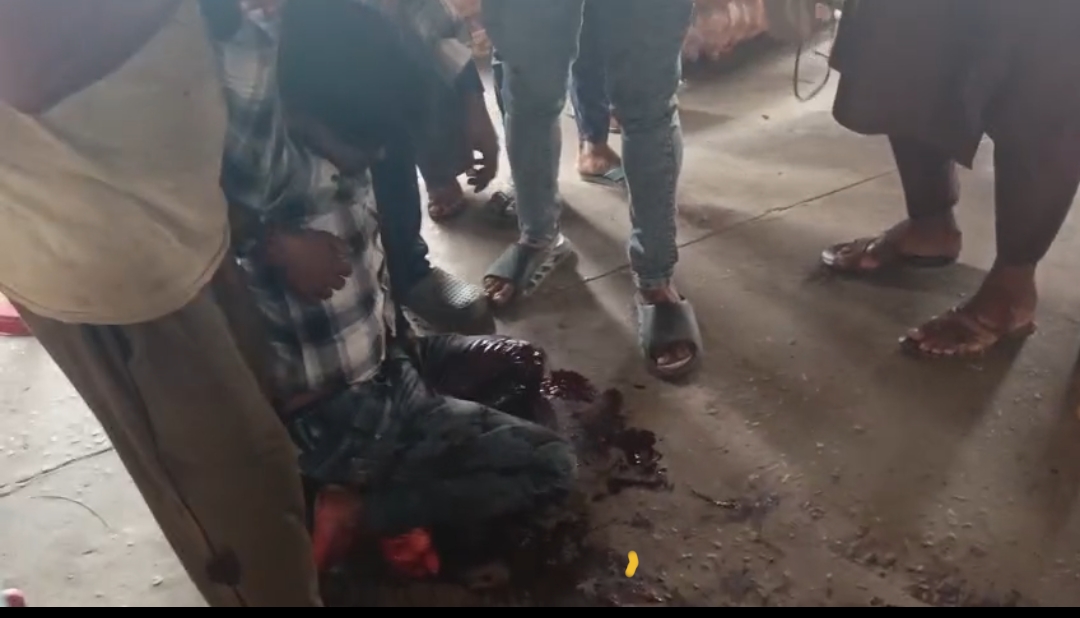 फायरिंग में घायल युवक