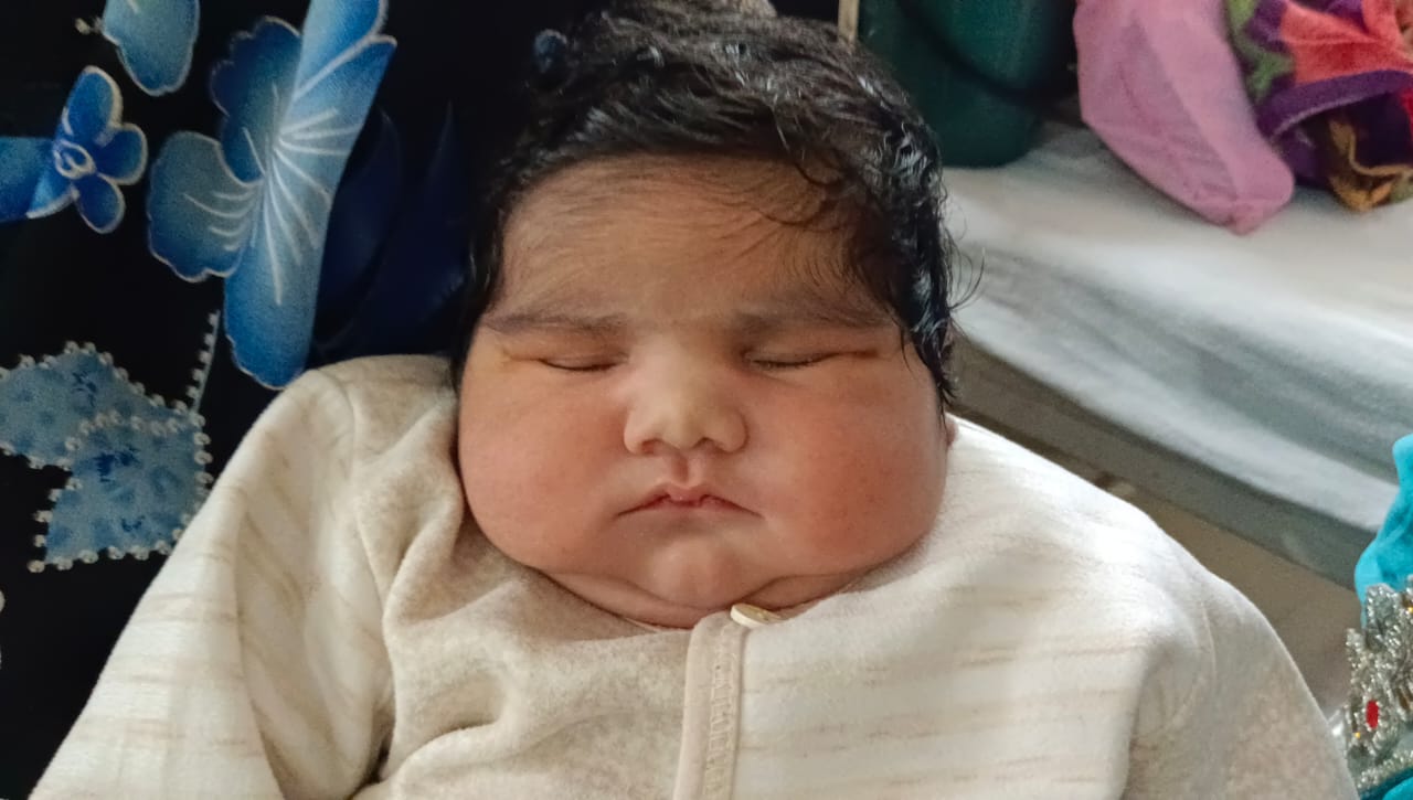 5 KG बच्चा