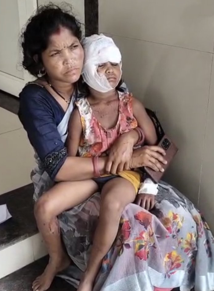 6 साल की मासूम को आवारा कुत्तों ने नोंचा.. सिर और शरीर पर गहरे जख्म, 6 साल की मासूम को आवारा कुत्तों ने नोंचा.. सिर और शरीर पर गहरे जख्म,