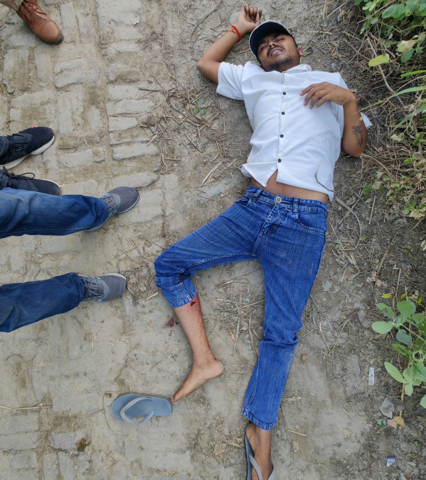 घायल बदमाश घायल बदमाश