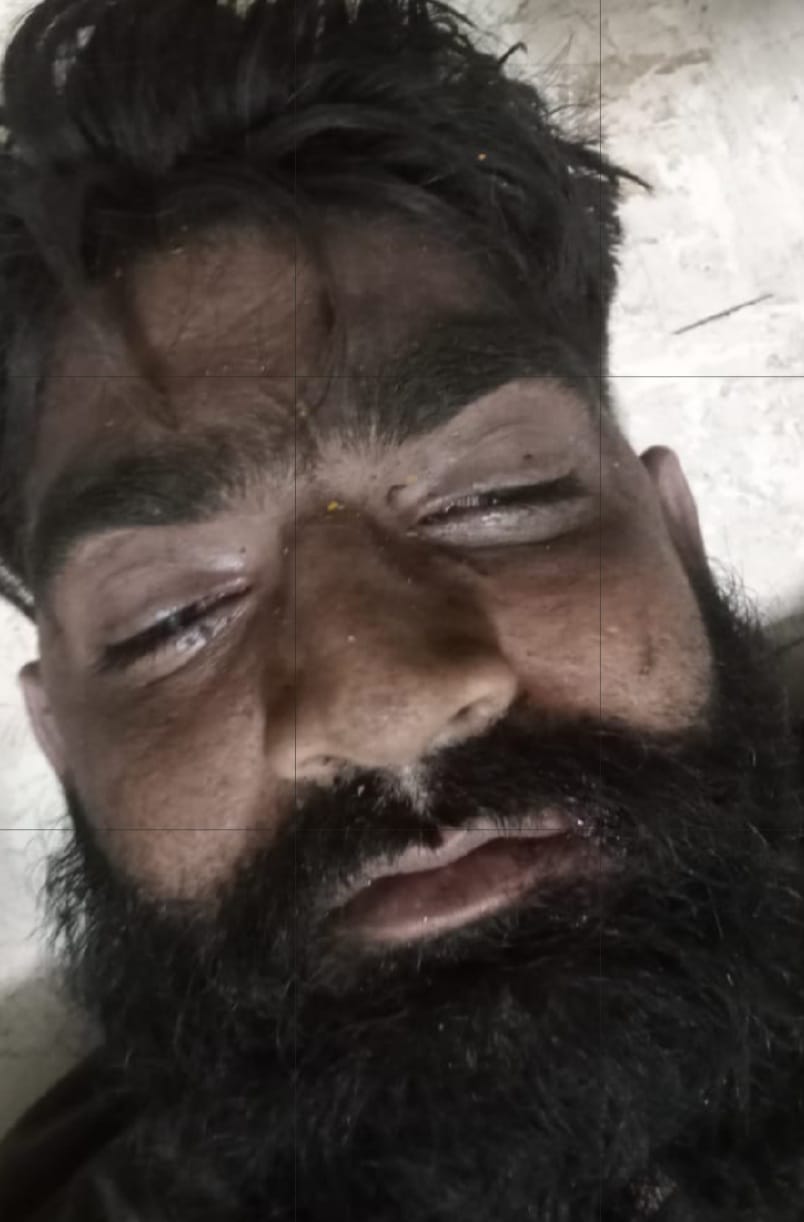 चपेट में आने युवक की मौत, जांच शुरु चपेट में आने युवक की मौत, जांच शुरु