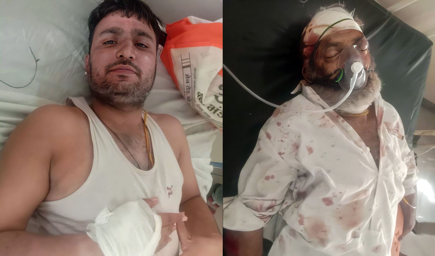 तेज रफ्तार कार ने बाइक सवार को टक्कर मारी, दो घायल तेज रफ्तार कार ने बाइक सवार को टक्कर मारी, दो घायल
