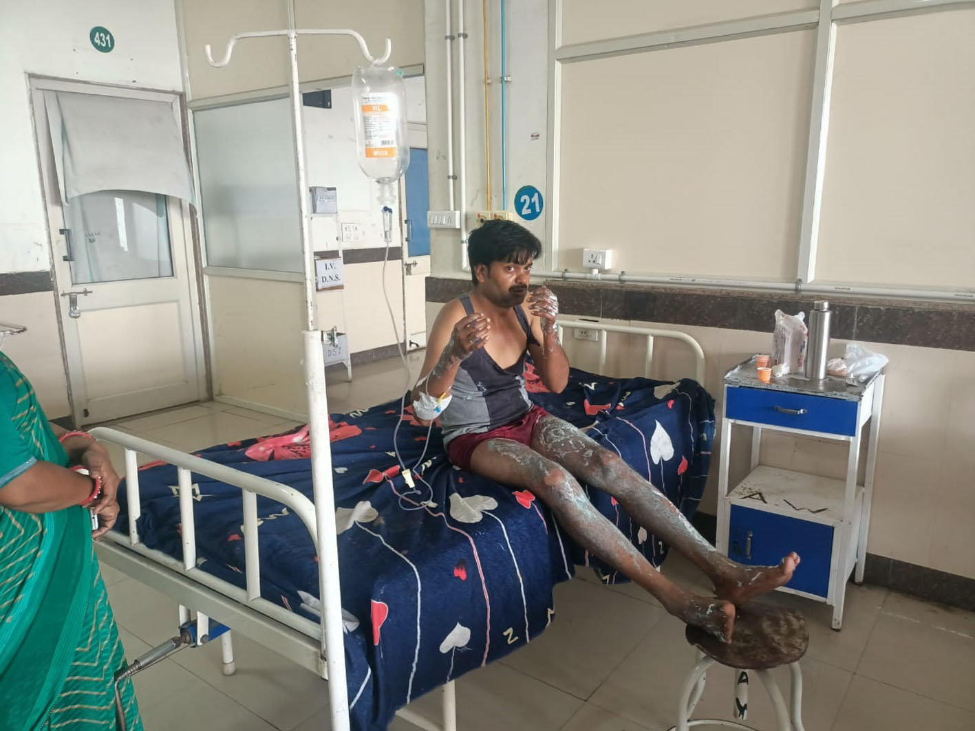ऑटो की टक्कर से पलटी गर्म तेल से भरी कढ़ाई, हलवाई झुलसा