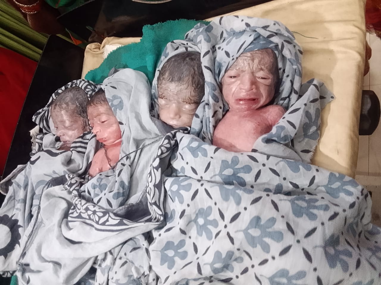 चार जन्मजात बच्चियों की तस्वीर