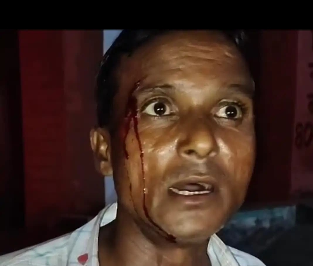 फोटो - घायल युवक
