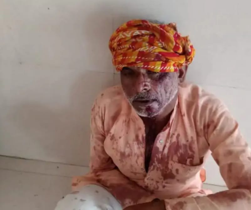 दो भाईयों के बीच खूनी संघर्ष,11 घायल एक गंभीर