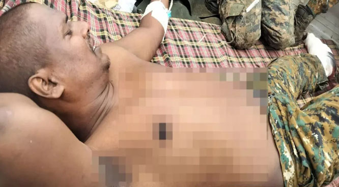 घायल जवान दीपक दूले घायल जवान दीपक दूले