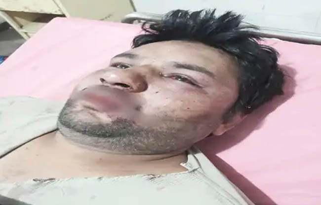 सोनीपत: पीड़ित घायल मोनू अस्पताल में सोनीपत: पीड़ित घायल मोनू अस्पताल में