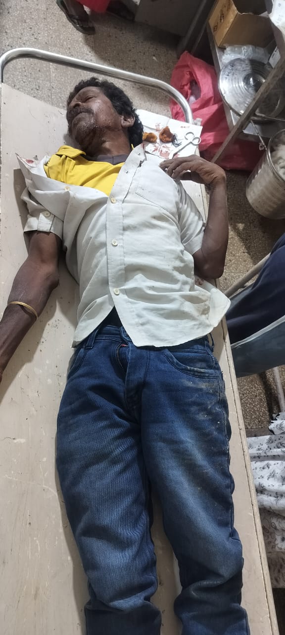 दुघर्टना में घायल व्यक्ति दुघर्टना में घायल व्यक्ति