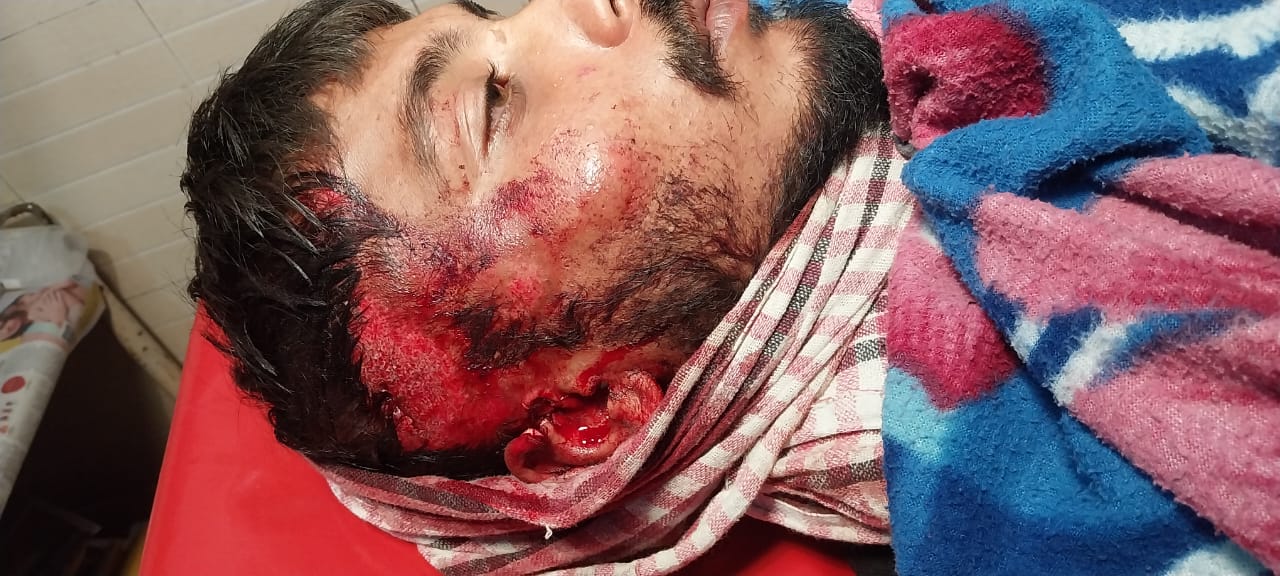 घायल दीपक