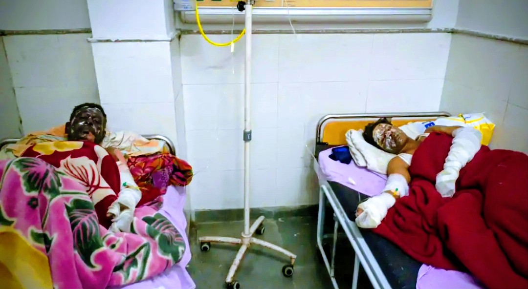 पानीपत में गैस सिलेंडर फटने से घायल अस्पताल में उपचाराधीन पानीपत में गैस सिलेंडर फटने से घायल अस्पताल में उपचाराधीन