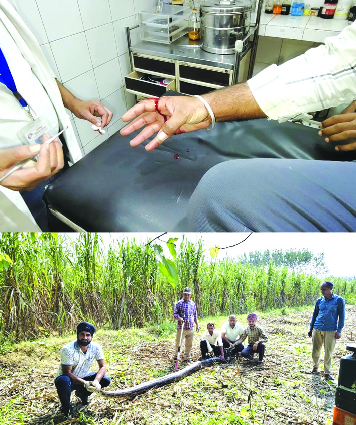 घायल वन कर्मी व रेस्क्यू किया अजगर घायल वन कर्मी व रेस्क्यू किया अजगर