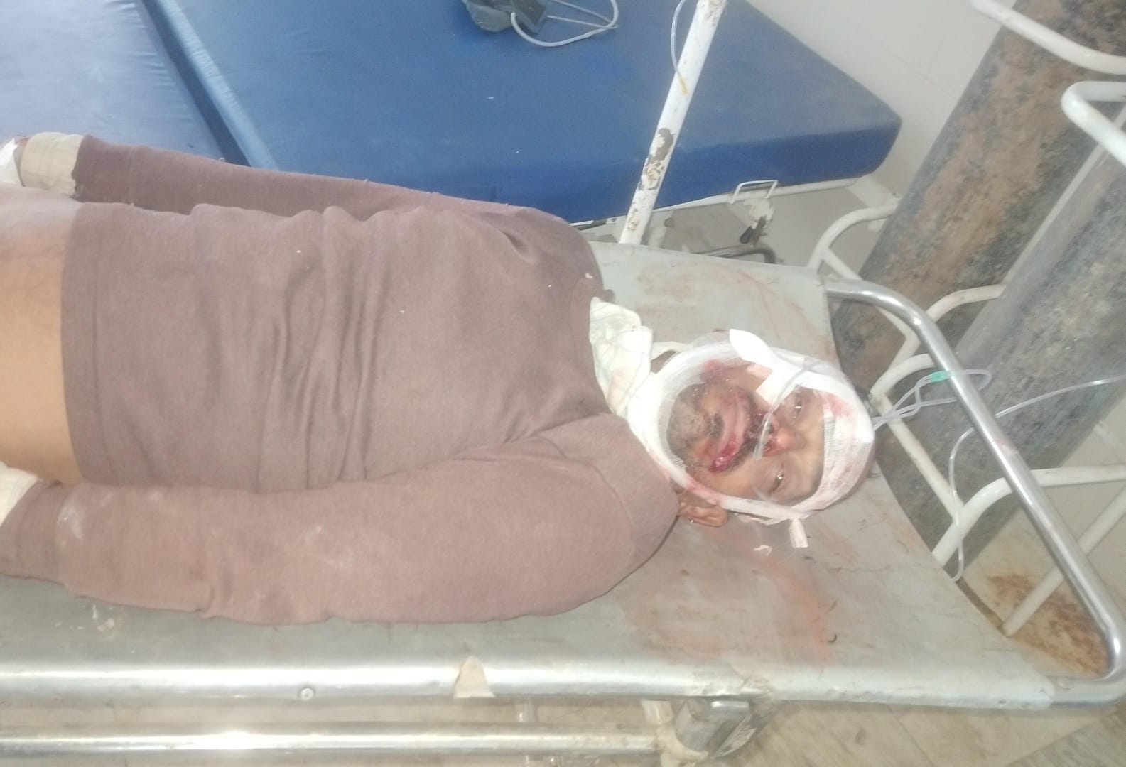 सड़क हादसे में दो युवक घायल,हालत गंभीर