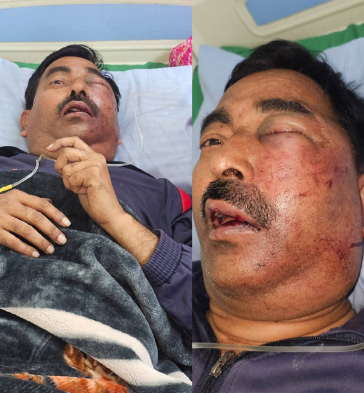 गंभीर अवस्था में पत्रकार सुशील अवस्थी