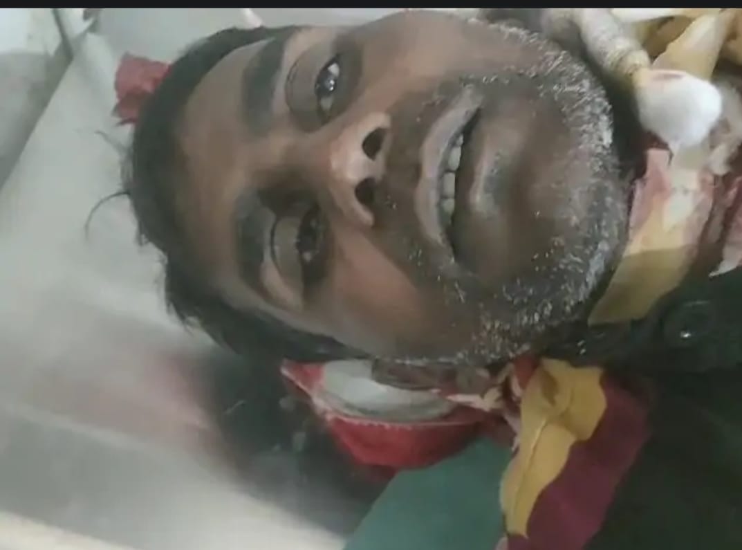 गर्दन में जिसे हसिया लगी उसका फोटो