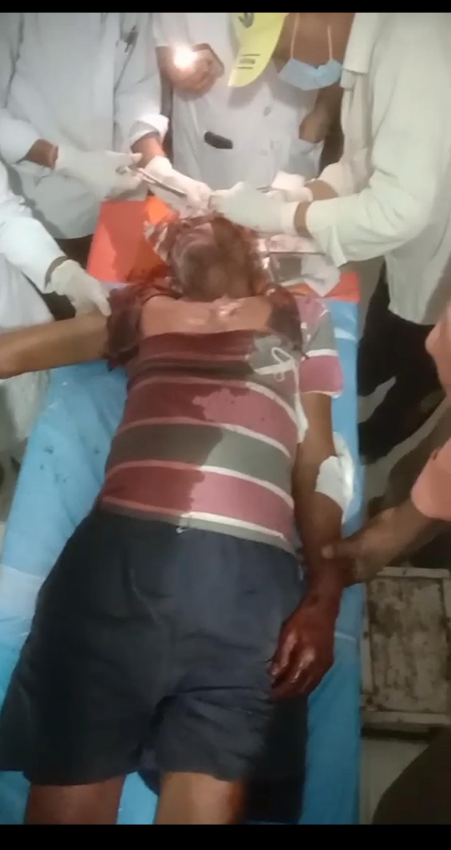 Seoni: Villager seriously injured after being attacked by tiger while grazing cattle in forest