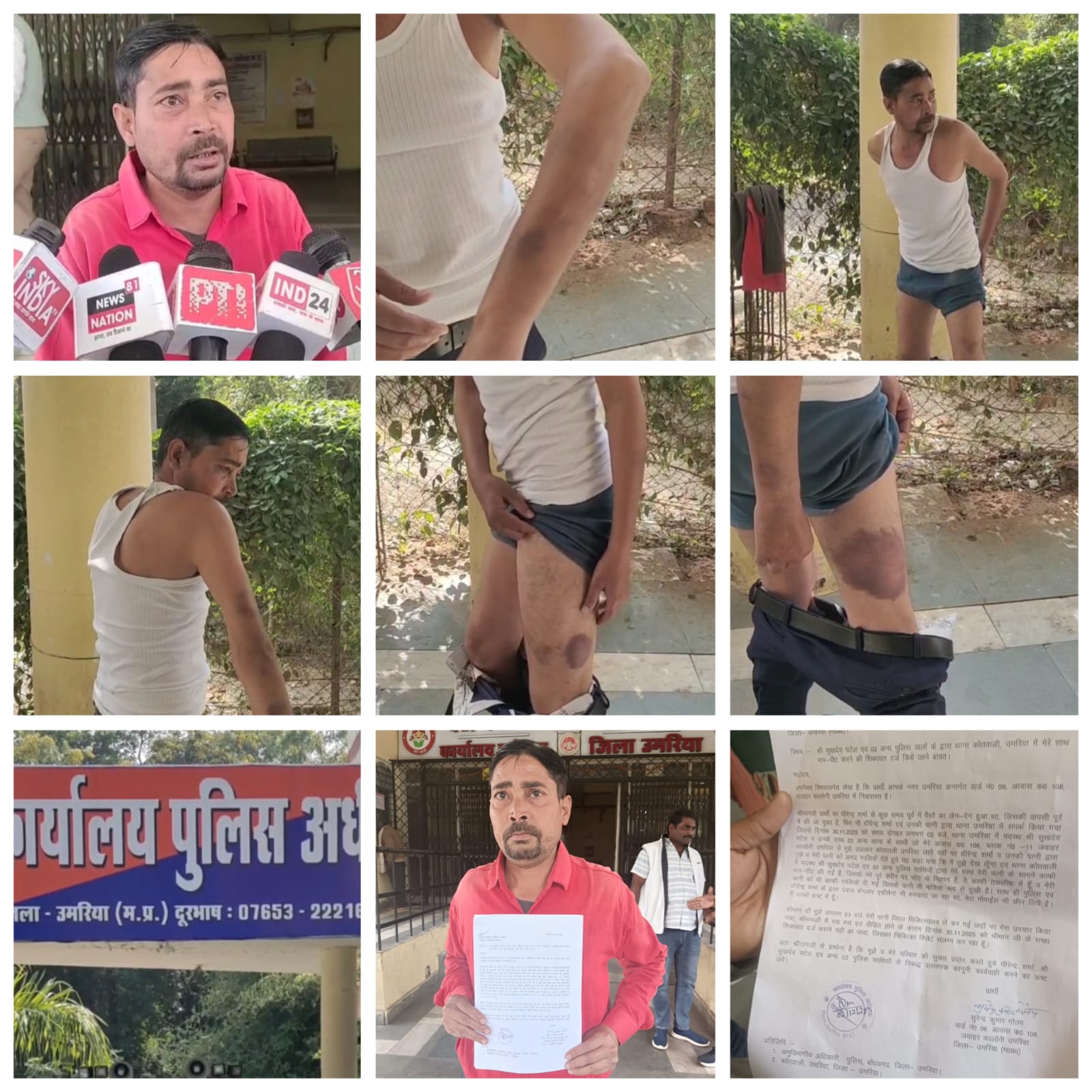 ओ माय गॉड ये पुलिस है या किराये का गुण्डा, बिना अपराध घर से उठा कर थाने मे किया मारपीट