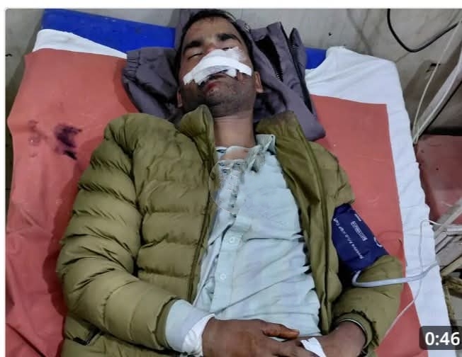 घायल शिवम लोहिया अस्पताल में भर्ती घायल शिवम लोहिया अस्पताल में भर्ती