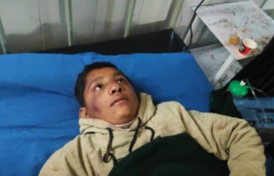 दुर्घटना में घायल की फोटो