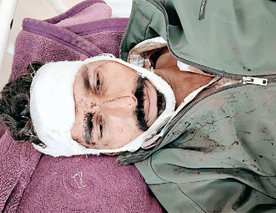 उज्जैन में 10 किग्रा आटा उठाने की बात पर हुआ खूनी संघर्ष उज्जैन में 10 किग्रा आटा उठाने की बात पर हुआ खूनी संघर्ष